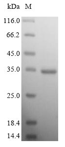 Greater than 90% as determined by SDS-PAGE.Recombinant Human Voltage-Dependent Calcium Channel Subunit Alpha-2/Delta-1 (CACNA2D1) Protein (His-SUMO)