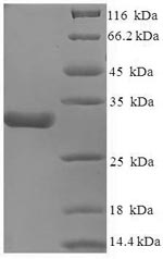 Greater than 85% as determined by SDS-PAGE.Recombinant Human Voltage-Dependent Calcium Channel Subunit Alpha-2/Delta-1 (CACNA2D1) Protein (His-SUMO)
