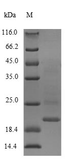 Greater than 90% as determined by SDS-PAGE.Recombinant Rat Calmodulin-1 (CALM1) Protein (His&Myc)