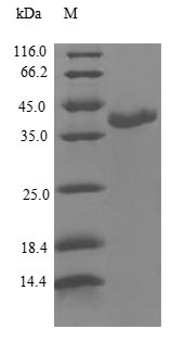 Greater than 90% as determined by SDS-PAGE.Recombinant Human Calmodulin-Like Protein 3 (CALML3) Protein (GST)