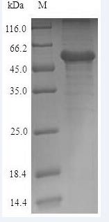 Greater than 90% as determined by SDS-PAGE.Recombinant Human Calreticulin (CALR) Protein (His)