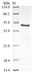 Greater than 90% as determined by SDS-PAGE.Recombinant Human Calreticulin (CALR) Protein (His)