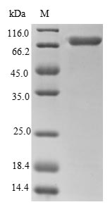 Greater than 85% as determined by SDS-PAGE.Recombinant Human Calreticulin (CALR) Protein (GST)