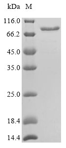 Greater than 90% as determined by SDS-PAGE.Recombinant Mouse Calreticulin (CALR) Protein (GST)