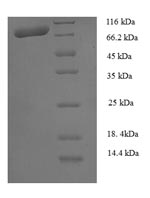 Greater than 90% as determined by SDS-PAGE.Recombinant Human Calpain-1 Catalytic Subunit (CAPN1) Protein (His)