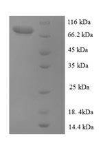 Greater than 90% as determined by SDS-PAGE.Recombinant Human Extracellular Calcium-Sensing Receptor (CASR) Protein (GST)