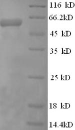 Greater than 90% as determined by SDS-PAGE.Recombinant Human Cystathionine Beta-Synthase (CBS) Protein (His)
