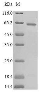 Greater than 90% as determined by SDS-PAGE.Recombinant Human Cystathionine Beta-Synthase (CBS) Protein (His-SUMO)