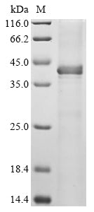 Greater than 90% as determined by SDS-PAGE.Recombinant Saccharomyces Cerevisiae Cystathionine Beta-Synthase (CYS4) Protein (His)
