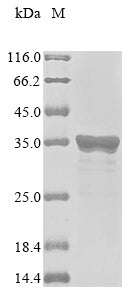 Greater than 85% as determined by SDS-PAGE.