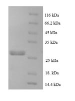 Greater than 90% as determined by SDS-PAGE.Recombinant Human C-C Motif Chemokine 16 (CCL16) Protein (His-SUMO)