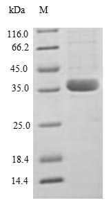 Greater than 90% as determined by SDS-PAGE.Recombinant Human C-C Motif Chemokine 2 (CCL2) Protein (GST)