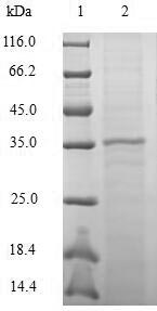 Greater than 90% as determined by SDS-PAGE.Recombinant Macaca Mulatta Chemokine Ccl20/Mip-3Alpha (CCL20) Protein (His-GST)