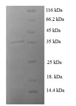 Greater than 90% as determined by SDS-PAGE.