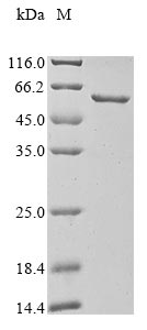 Greater than 90% as determined by SDS-PAGE.Recombinant Human G2/Mitotic-Specific Cyclin-B1 (CCNB1) Protein (His&Myc)