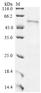Greater than 90% as determined by SDS-PAGE.Recombinant Human G2/Mitotic-Specific Cyclin-B1 (CCNB1) Protein (His)