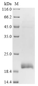 Greater than 85% as determined by SDS-PAGE.Recombinant Human C-C Chemokine Receptor Type 1 (CCR1) Protein (His-SUMO)