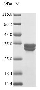 Greater than 90% as determined by SDS-PAGE.Recombinant Human C-C Chemokine Receptor Type 9 (CCR9) Protein (GST)