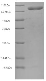 Greater than 90% as determined by SDS-PAGE.Recombinant Human T-Complex Protein 1 Subunit Beta (CCT2) Protein (His-SUMO)