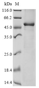 Greater than 85% as determined by SDS-PAGE.Recombinant Human Adp-Ribosyl Cyclase/Cyclic Adp-Ribose Hydrolase 1 (CD38) Protein (GST)