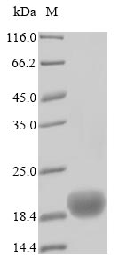 Greater than 90% as determined by SDS-PAGE.Recombinant Human Campath-1 Antigen (CD52) Protein (His)