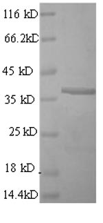 Greater than 90% as determined by SDS-PAGE.Recombinant Mouse Cd63 Antigen (CD63) Protein (GST)