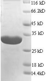 Greater than 90% as determined by SDS-PAGE.Recombinant Mouse H-2 Class Ii Histocompatibility Antigen Gamma Chain (CD74) Protein (His)