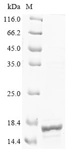 Greater than 85% as determined by SDS-PAGE.Recombinant Human Cd81 Antigen (CD81) Protein (His&Myc)