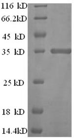 Greater than 90% as determined by SDS-PAGE.