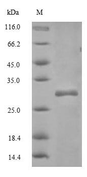 Greater than 90% as determined by SDS-PAGE.Recombinant Mouse Cd82 Antigen (CD82) Protein (His-SUMO)