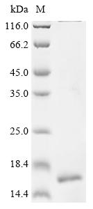 Greater than 90% as determined by SDS-PAGE.Recombinant Human Cd9 Antigen (CD9) Protein (His&Myc)