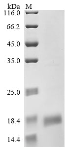Greater than 90% as determined by SDS-PAGE.Recombinant Mouse Cd9 Antigen (CD9) Protein (His&Myc)