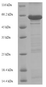 Greater than 90% as determined by SDS-PAGE.Recombinant Human Cadherin-1 (CDH1) Protein (His)