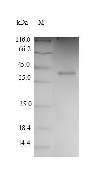 Greater than 90% as determined by SDS-PAGE.Recombinant Human Cyclin-Dependent Kinase 2 (CDK2) Protein (His)