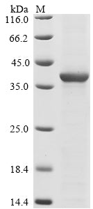 Greater than 85% as determined by SDS-PAGE.Recombinant Human Cyclin-Dependent Kinase 5 (CDK5) Protein (His)