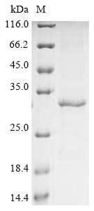 Greater than 85% as determined by SDS-PAGE.Recombinant Human Cyclin-Dependent Kinase 5 (CDK5)