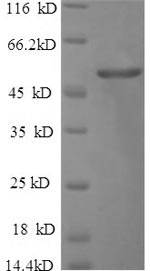 Greater than 90% as determined by SDS-PAGE.Recombinant Human Cerebellar Degeneration-Related Protein 2 (CDR2 PCD17) Protein (His)