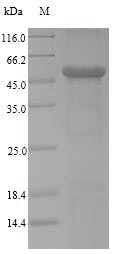 Greater than 90% as determined by SDS-PAGE.Recombinant Human Carcinoembryonic Antigen-Related Cell Adhesion Molecule 1 (CEACAM1) Protein (His-SUMO&Myc)