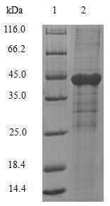 Greater than 90% as determined by SDS-PAGE.Recombinant Human Carcinoembryonic Antigen-Related Cell Adhesion Molecule 1 (CEACAM1)
