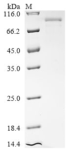 Greater than 85% as determined by SDS-PAGE.Recombinant Human Major Centromere Autoantigen B (CENPB) Protein (His)
