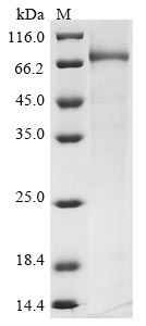 Greater than 85% as determined by SDS-PAGE.Recombinant Human Choline O-Acetyltransferase (CHAT) Protein (His)