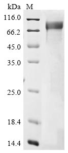 Greater than 85% as determined by SDS-PAGE.Recombinant Human Choline O-Acetyltransferase (CHAT) Protein (His&Myc)