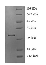 Greater than 90% as determined by SDS-PAGE.Recombinant Mouse Acetylcholine Receptor Subunit Alpha (CHRNA1) Protein (His)