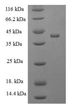 Greater than 90% as determined by SDS-PAGE.Recombinant Mouse Acetylcholine Receptor Subunit Alpha (CHRNA1) Protein (His-SUMO)