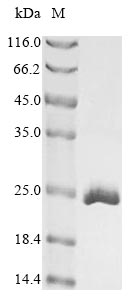 Greater than 90% as determined by SDS-PAGE.Recombinant Mouse Cold-Inducible Rna-Binding Protein (CIRBP) Protein (His)