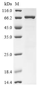 Greater than 85% as determined by SDS-PAGE.Recombinant Human Creatine Kinase M-Type (CKM) Protein (GST)