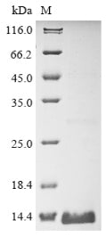 Greater than 90% as determined by SDS-PAGE.Recombinant Rat Claudin-1 (CLDN1) Protein (His&Myc)