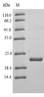 Greater than 90% as determined by SDS-PAGE.Recombinant Human Claudin-3 (CLDN3) Protein (His-B2M)