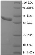 Greater than 90% as determined by SDS-PAGE.Recombinant Mouse Clathrin Light Chain A (CLTA) Protein (His-SUMO)