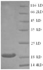 Greater than 90% as determined by SDS-PAGE.Recombinant Human Clathrin Heavy Chain 2 (CLTCL1) Protein (His)